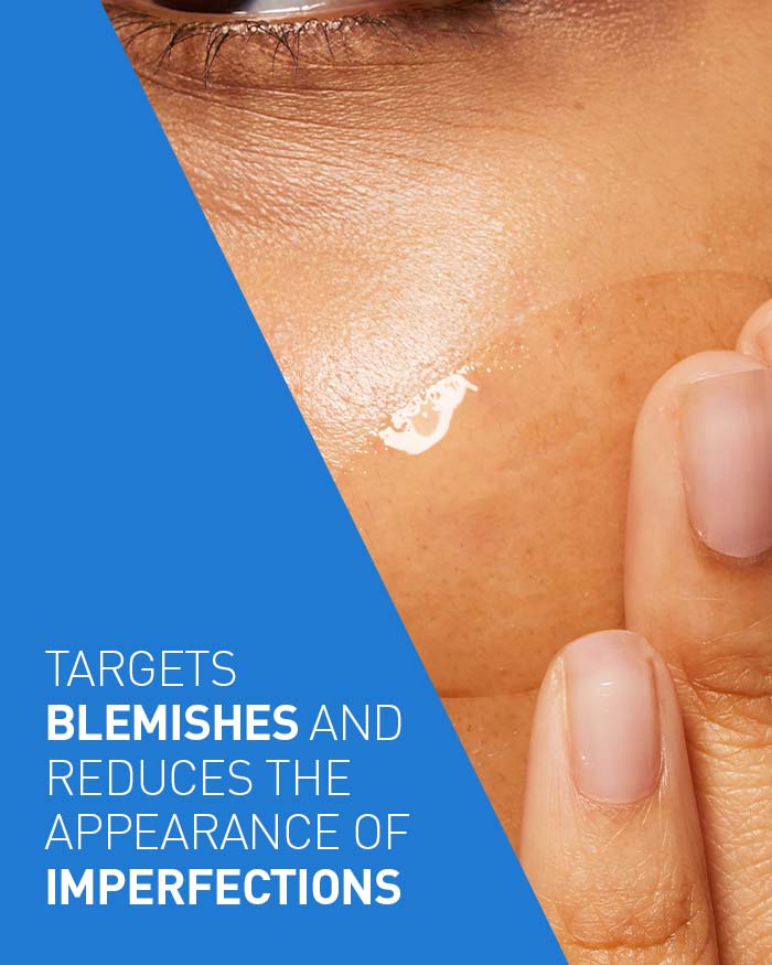 Blemish Control Gel for Acne-Prone Skin | CeraVe Australia